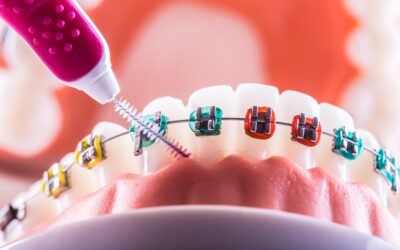 Mi az a szájhigiéniai tanácsadás?