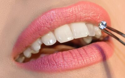 Mit kell tudni a fogékszerről?